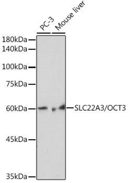 Anti-SLC22A3/OCT3 Antibody (CAB19758)