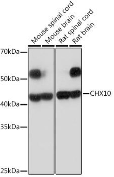 Anti-CHX10 Antibody (CAB19828)