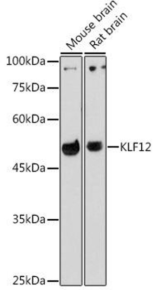 Anti-KLF12 Antibody (CAB20469)