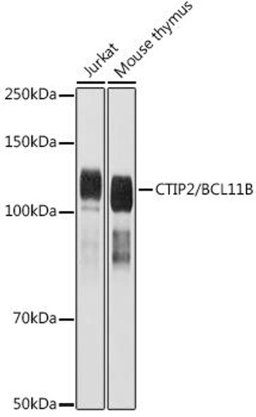 Anti-CTIP2/BCL11B Antibody (CAB20483)