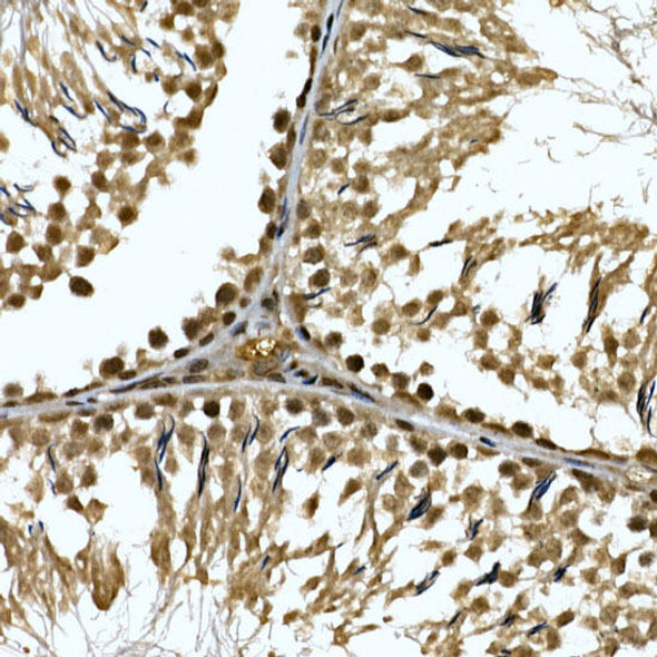 ZNF213 Polyclonal Antibody (CAB20685)