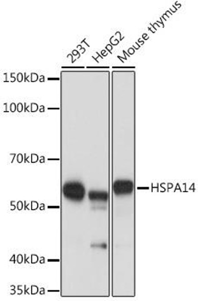 Anti-HSPA14 Antibody (CAB2286)