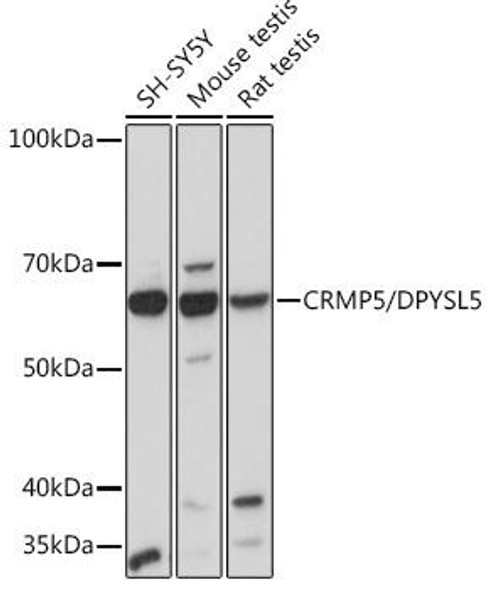 Anti-CRMP5/DPYSL5 Antibody (CAB3503)