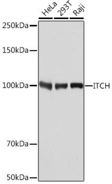 Anti-ITCH [KO Validated] Antibody (CAB8624)
