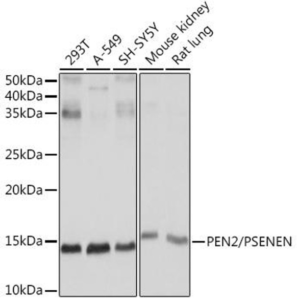 Anti-PEN2/PSENEN Antibody (CAB8678)