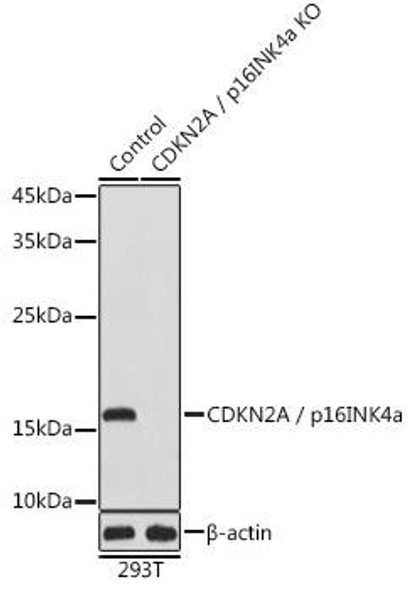 Anti-CDKN2A / p16INK4a Antibody (CAB0262)[KO Validated]