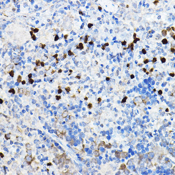 Anti-TREM2 Antibody (CAB10482)