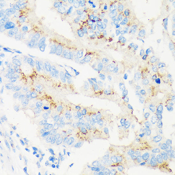 Anti-MAN1A2 Antibody (CAB14271)