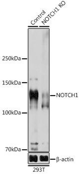 Anti-NOTCH1 Antibody (CAB16675)[KO Validated]