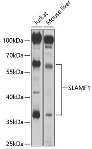 Anti-SLAMF1 Antibody (CAB2044)