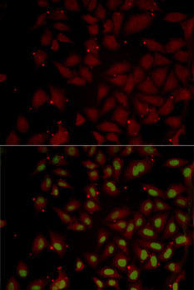 Anti-CCL25 Antibody (CAB2685)