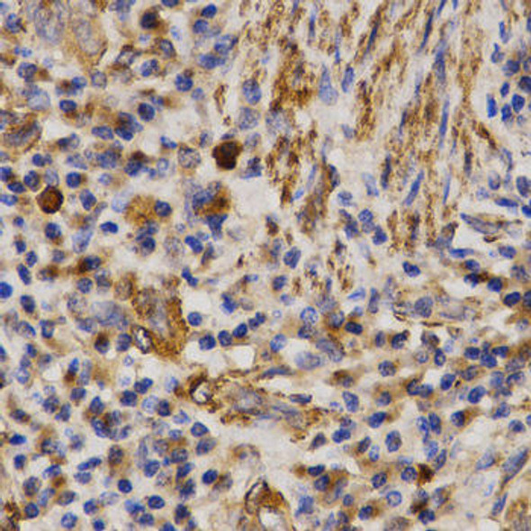 Anti-MMP25 Antibody (CAB3032)