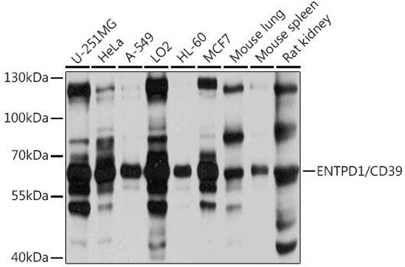 Anti-ENTPD1/CD39 Antibody (CAB3778)