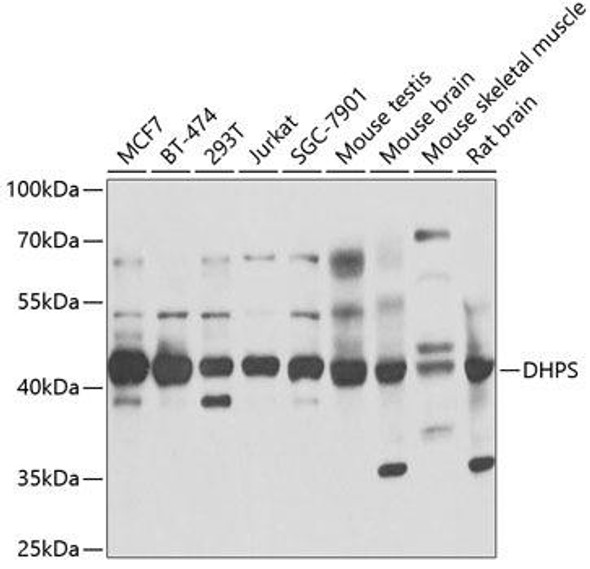 Anti-DHPS Antibody (CAB6367)