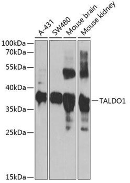 Anti-TALDO1 Antibody (CAB6762)
