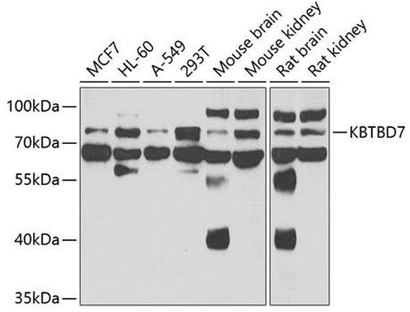 Anti-KBTBD7 Antibody (CAB7392)