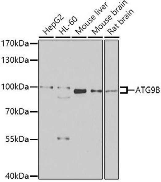 Anti-ATG9B Antibody (CAB7406)