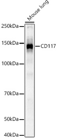 CD117 Polyclonal Antibody (CAB21301)