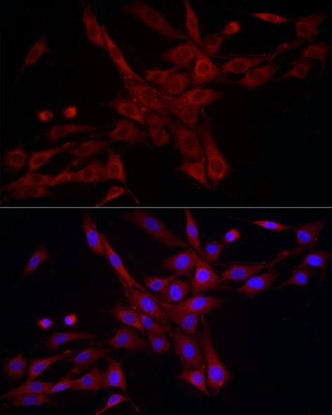 DNM1L Polyclonal Antibody (CAB21311)