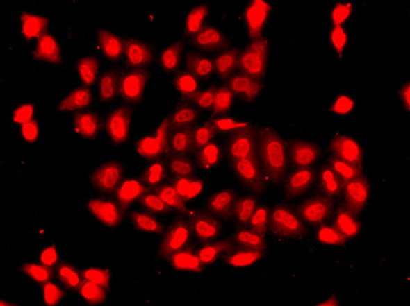 Anti-CAMK1D Antibody (CAB7512)