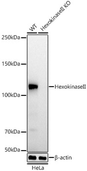 Hexokinase II Monoclonal Antibody (CAB22319)