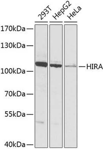 Anti-Protein HIRA Antibody (CAB8461)