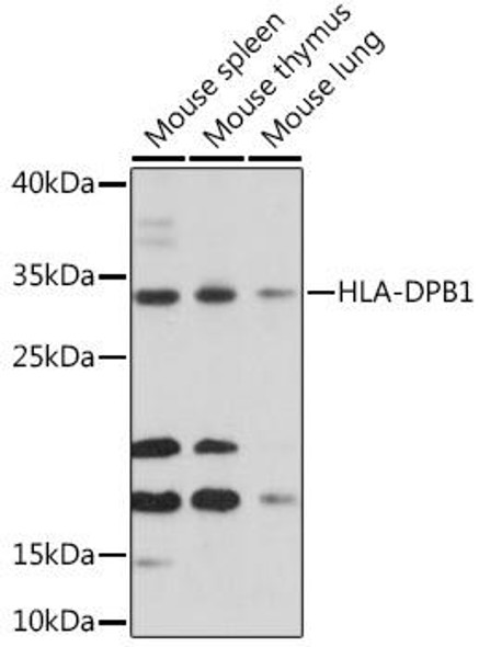 Anti-HLA-DPB1 Antibody (CAB16874)