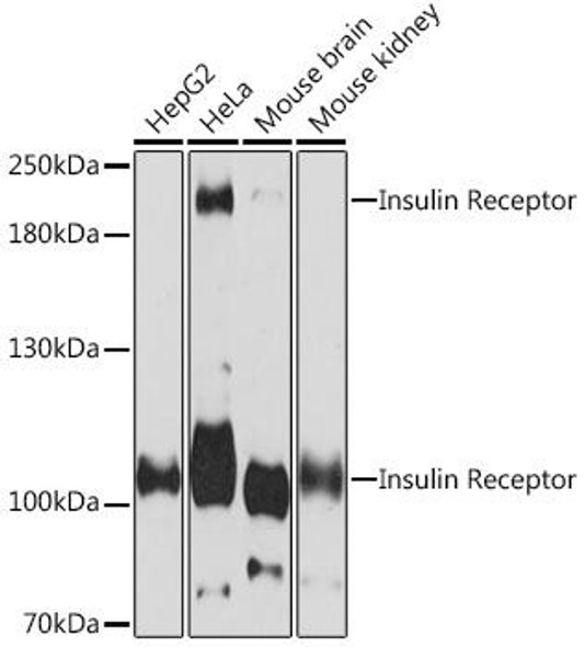 Anti-Insulin Receptor Antibody (CAB16900)