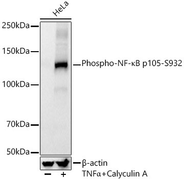 Phospho-NF-κB p105-S932 Monoclonal Antibody (CABP1355)
