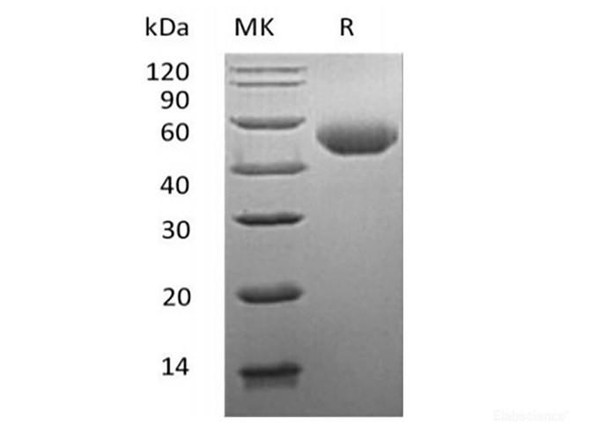 Recombinant Mouse Alpha-1-antitrypsin 1-1/Serpin A1e (C-6His) (RPES6628)