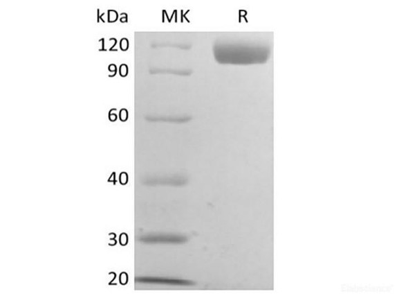 Recombinant Mouse B-cell Receptor CD22/Siglec-2/CD22 (C-6His) (RPES6659)
