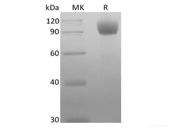 Recombinant Mouse Angiotensin-Converting Enzyme 2/ACE-2 (C-10His) (RPES6669)