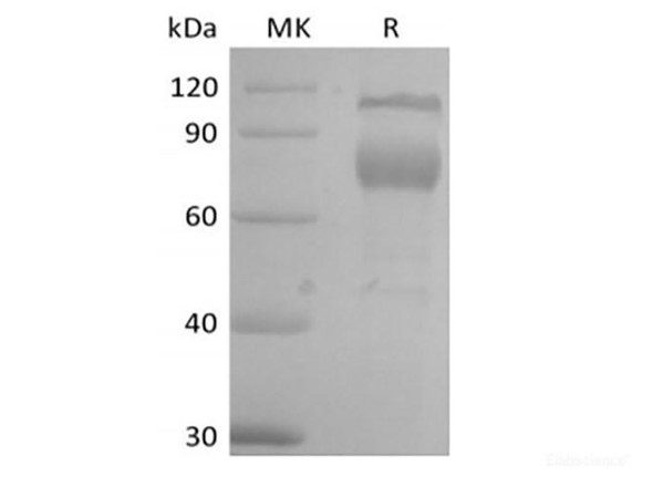 Recombinant Mouse IL-2 Receptor Subunit Beta/IL-2RB/CD122 (C-Fc) (RPES6671)