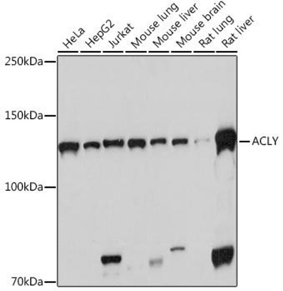 Anti-ACLY Antibody (CAB3719)