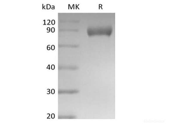 Recombinant Mouse Siglec-E (C-Fc) (RPES6682)