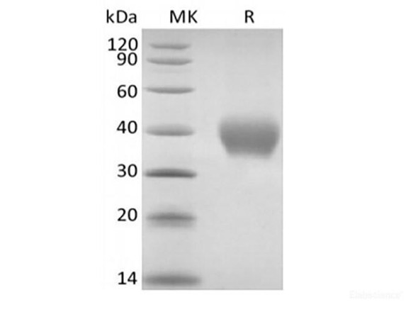 Recombinant Rhesus Macaque TNF Receptor II/TNF RII/TNFRSF1B/CD120b  (C-6His) (RPES6788)