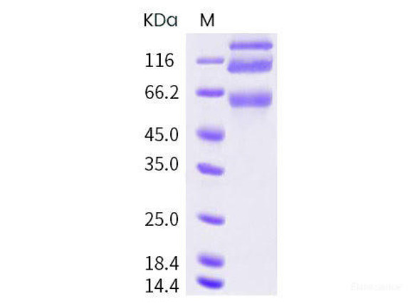 HCoV-OC43 S1+S2 Recombinant Protein (ECD, His Tag) (RPES6811)