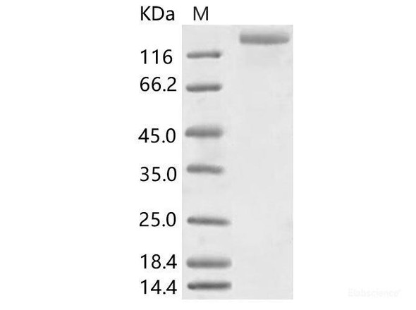 HCoV-NL63 S1+S2 Recombinant Protein (ECD, His Tag) (RPES6876)