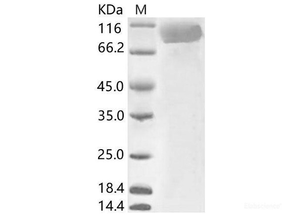 HCoV-229E S1 Recombinant Protein (His Tag) (RPES6880)