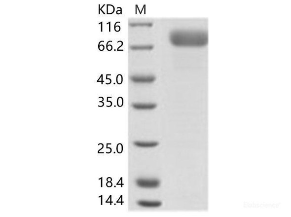 EBOV (subtype Bundibugyo, strain Uganda 2007) GlycoRecombinant Protein / GP-RBD Recombinant Protein (Fc Tag) (RPES6899)