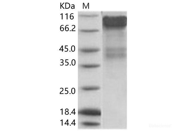 EBOV (subtype Bundibugyo, strain Uganda 2007) GP1 / GlycoRecombinant Protein Recombinant Protein (His Tag) (RPES6900)