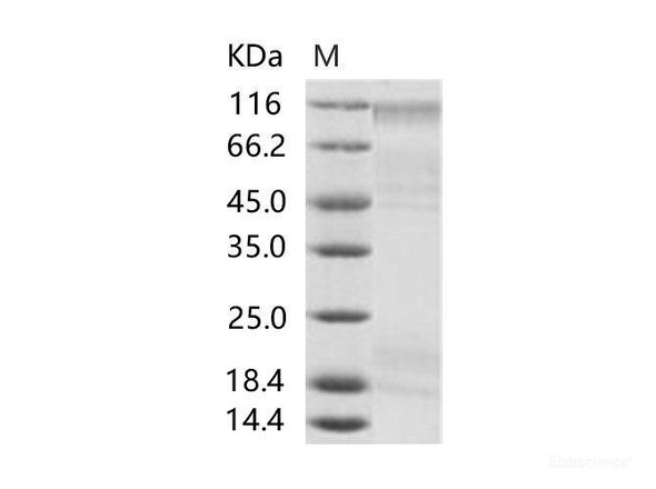 EBOV (Subtype Sudan, strain Gulu) GlycoRecombinant Protein / GP Recombinant Protein (aa:Met1-Asn637, His Tag) (RPES6904)