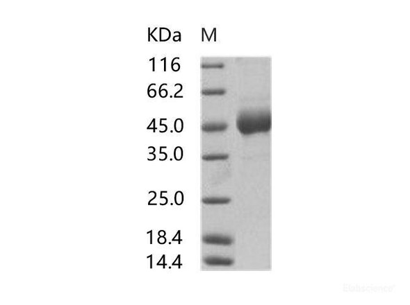 EBOV (Subtype Sudan, strain Gulu) GlycoRecombinant Protein / GP1 (mucin domain deleted) Recombinant Protein (His Tag) (RPES6906)