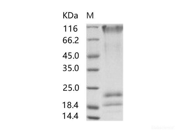 EBOV (subtype Sudan, strain Gulu) GP / GlycoRecombinant Protein Recombinant Protein (His Tag) (RPES6907)
