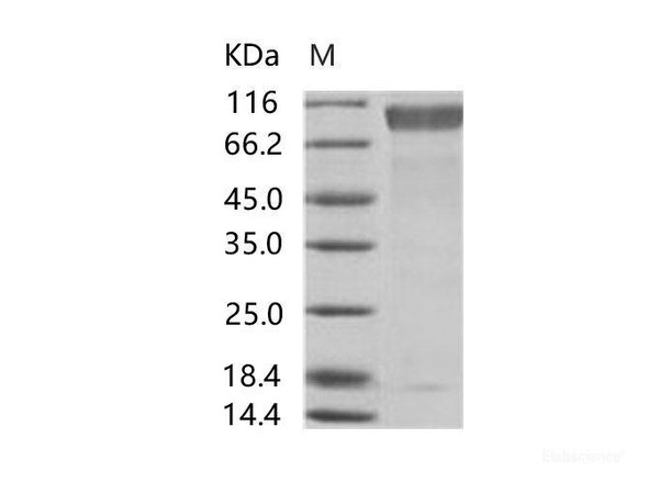 EBOV (subtype Sudan, strain Gulu) GP1 / GlycoRecombinant Protein Recombinant Protein (His Tag) (RPES6909)