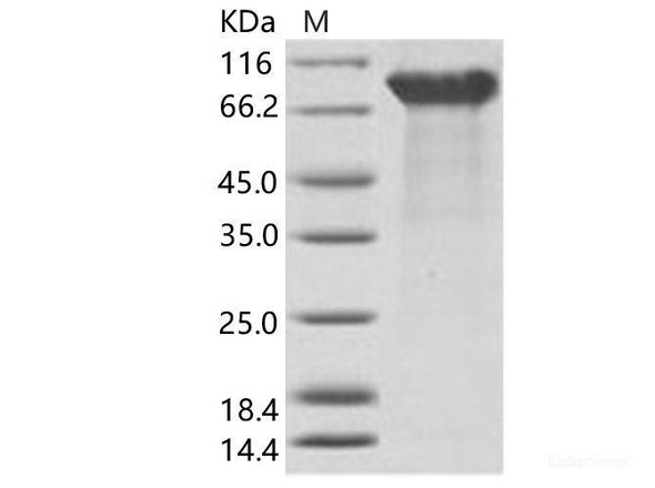 EBOV (subtype Zaire, strain H.sapiens-wt/GIN/2014/Kissidougou-C15) GlycoRecombinant Protein / GP1 Recombinant Protein (His Tag) (RPES6916)