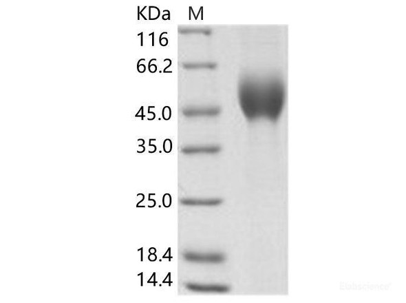 EBOV (subtype Zaire, strain H.sapiens-wt/GIN/2014/Kissidougou-C15) GlycoRecombinant Protein / GP-RBD Recombinant Protein (His Tag) (RPES6918)