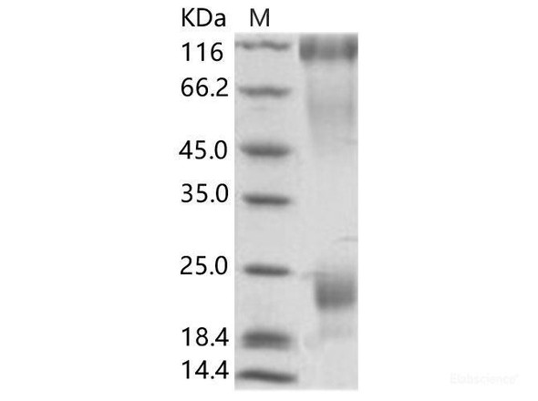 EBOV (subtype Zaire, strain H.sapiens-wt/GIN/2014/Kissidougou-C15) GP / GlycoRecombinant Protein Recombinant Protein (His Tag) (RPES6919)
