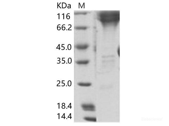 EBOV (subtype Zaire, strain H.sapiens-wt/GIN/2014/Kissidougou-C15) GP2 / GlycoRecombinant Protein Recombinant Protein (Fc Tag) (RPES6921)