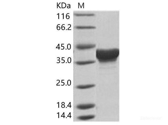 EBOV (subtype Zaire, strain H.sapiens-wt/GIN/2014/Kissidougou-C15) Matrix Recombinant Protein VP40 Recombinant Protein (His Tag) (RPES6922)
